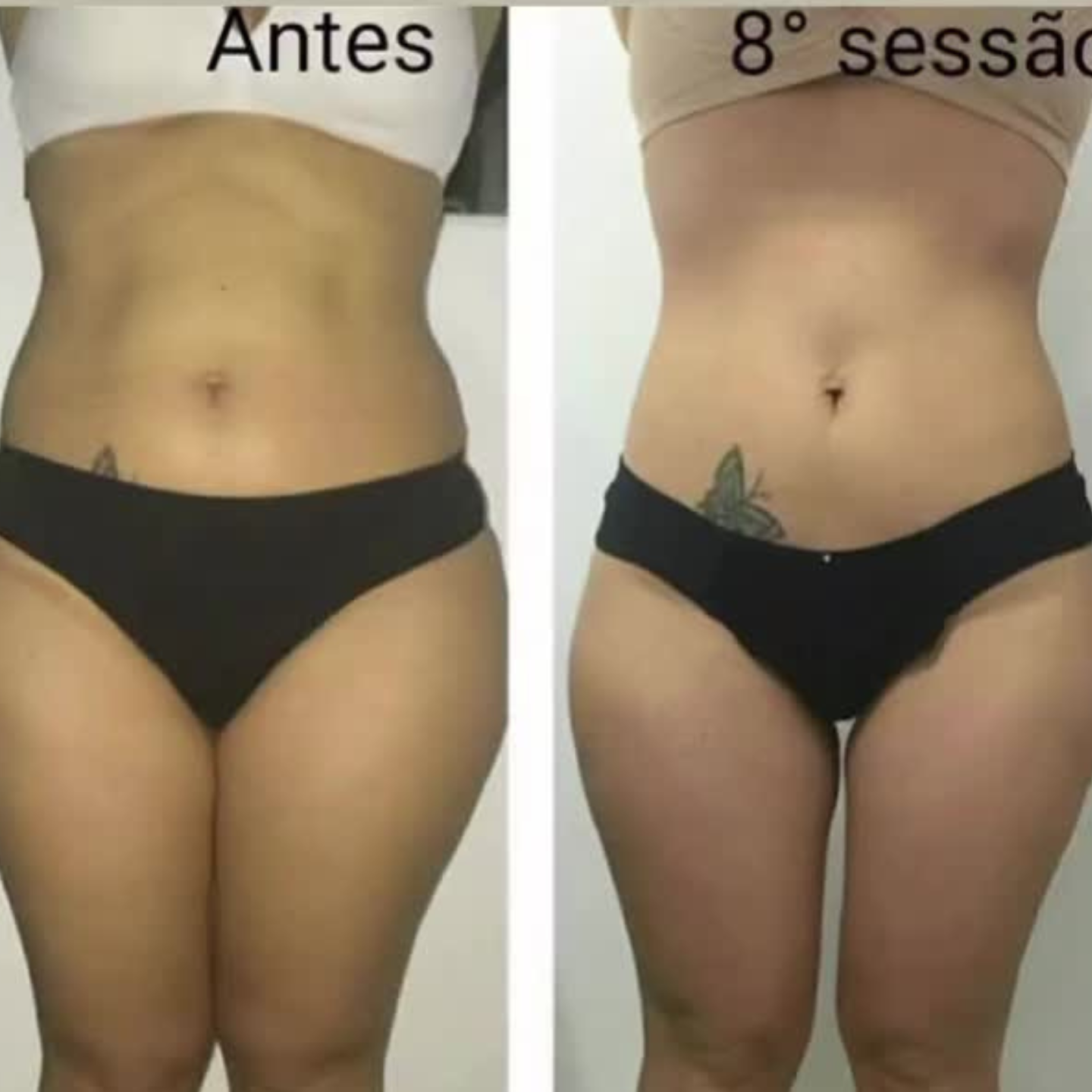 Power Shape no Cambuí, Campinas - Face Center Cambuí